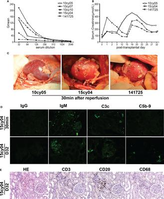 Establishment of a Hyperacute Rejection Model of ABO-Incompatible Renal Transplantation in Nonhuman Primates